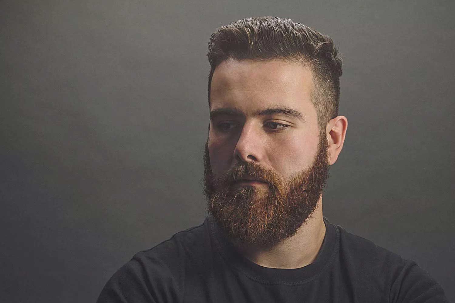 Beard transplant in Turkey